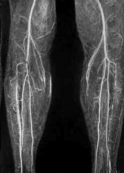 Buque x -ray