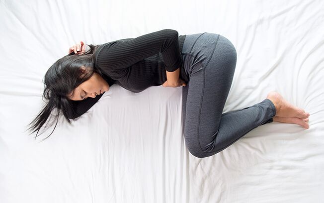 Varices da pelve nunha muller